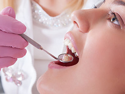 A dental professional is performing a teeth cleaning procedure on a patient's mouth.
